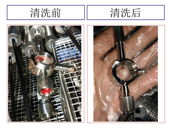 讓醫療手術(shù)更安全丨軟式管腔器械如何清洗
